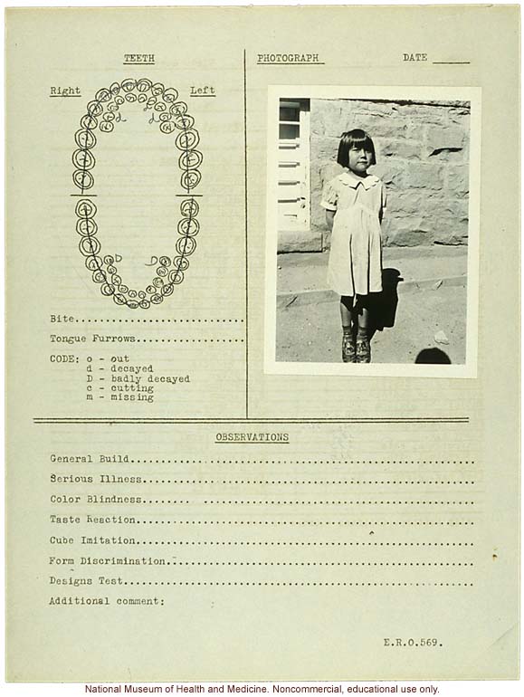 &quote;Growing Series&quote; of Navajo Female age 4-11, Fort Defiance, Arizona (anthropometry, dental charts, and photographs)