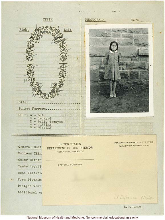 &quote;Growing Series&quote; of Navajo Female age 4-11, Fort Defiance, Arizona (anthropometry, dental charts, and photographs)