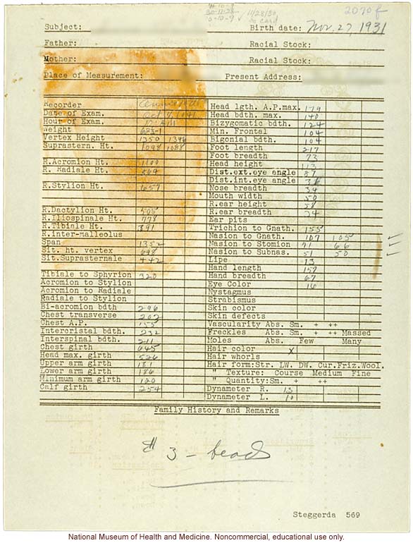 &quote;Growing Series&quote; of Navajo Female age 4-11, Fort Defiance, Arizona (anthropometry, dental charts, and photographs)