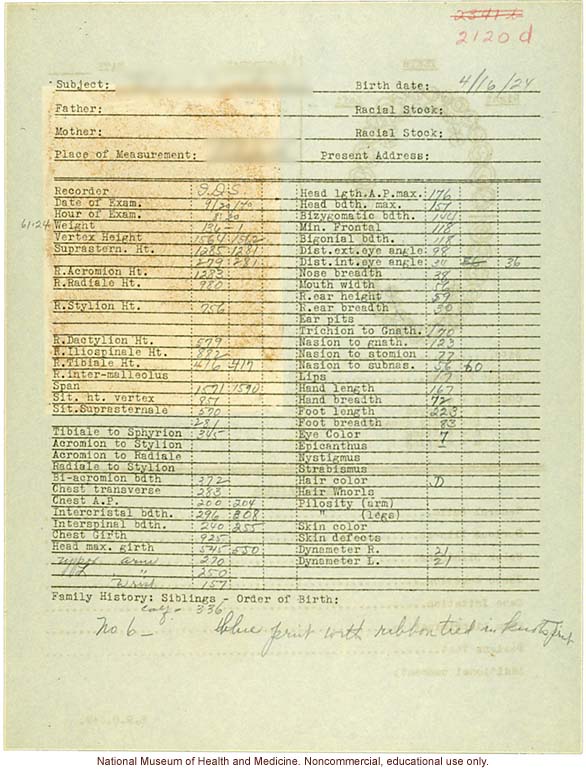 &quote;Growing Series&quote; of partial albino Hopi Female age 10-16, Ganado, Arizona (anthropometry, dental charts, and photographs)