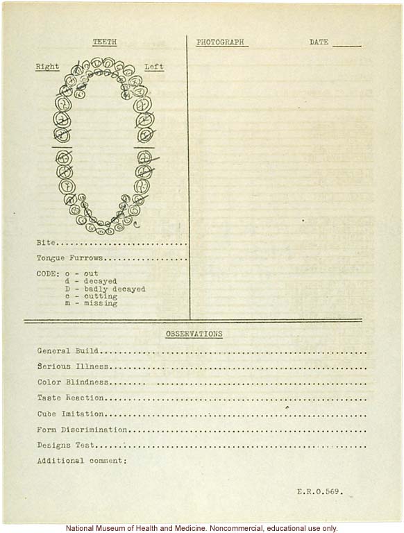 &quote;Growing Series&quote; of Navajo Male age 8-18, Tuba City and Ganado, Arizona (anthropometry, dental charts, and photographs)