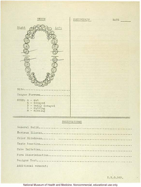&quote;Growing Series&quote; of Navajo Male age 8-18, Tuba City and Ganado, Arizona (anthropometry, dental charts, and photographs)