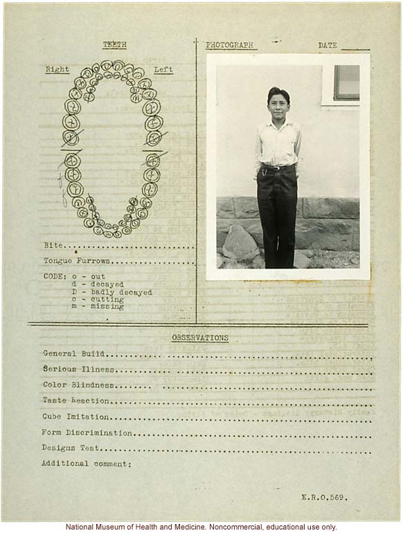 &quote;Growing Series&quote; of Navajo Male age 8-18, Tuba City and Ganado, Arizona (anthropometry, dental charts, and photographs)