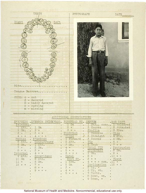 &quote;Growing Series&quote; of Navajo Male age 8-18, Tuba City and Ganado, Arizona (anthropometry, dental charts, and photographs)
