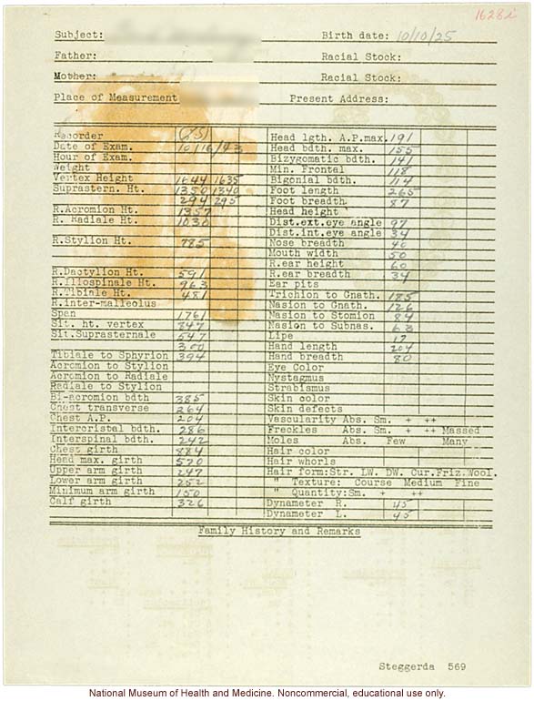 &quote;Growing Series&quote; of Navajo Male age 8-18, Tuba City and Ganado, Arizona (anthropometry, dental charts, and photographs)
