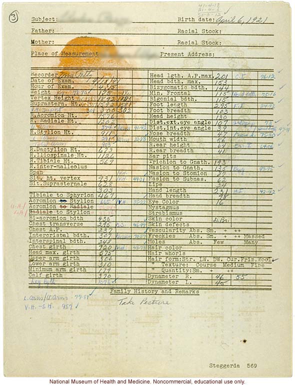 Male anthropometric case, from &quote;100 College Boys,&quote; Tuskegee Institute, Alabama (measurements, dental chart, and photograph)