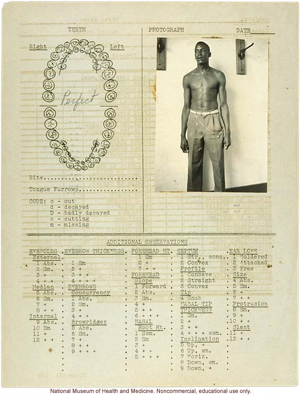 Male anthropometric case, from &quote;100 College Boys,&quote; Tuskegee Institute, Alabama (measurements, dental chart, and photograph)