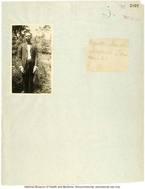 Seaford Town male anthropometric case: photo, measurements, finger prints, Schedule 3, notes; by Morris Steggerda for <i>Race Crossing in Jamaica</i>