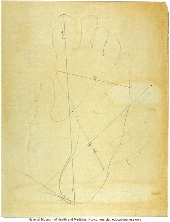 Seaford Town male anthropometric case: photo, measurements, finger prints, Schedule 3, notes; by Morris Steggerda for <i>Race Crossing in Jamaica</i>