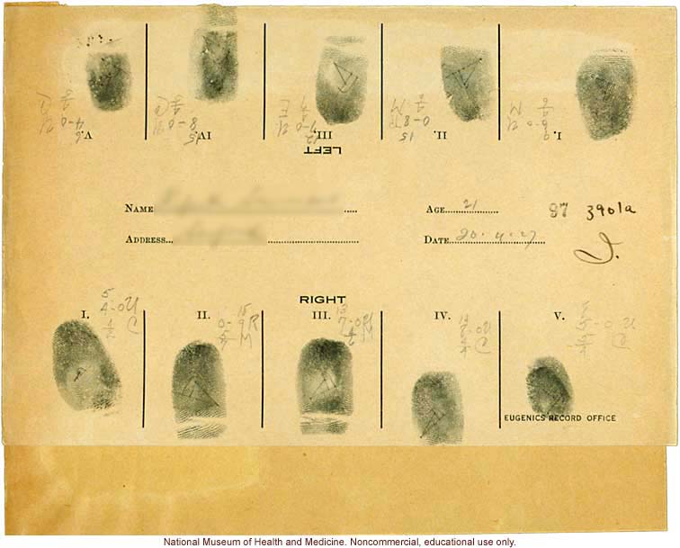 Seaford Town male anthropometric case: photo, measurements, finger prints, Schedule 3, notes; by Morris Steggerda for <i>Race Crossing in Jamaica</i>