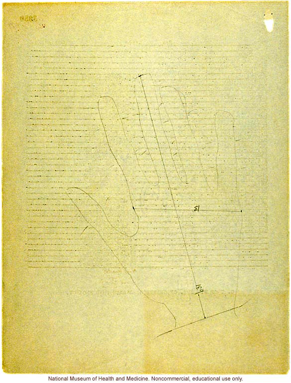 Seaford Town female anthropometric case: photos, measurements, finger prints, Schedule 3; by Morris Steggerda for <i>Race Crossing in Jamaica</i>