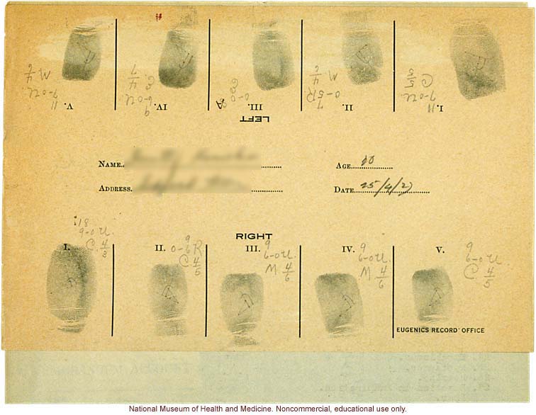 Seaford Town female anthropometric case: photos, measurements, finger prints, Schedule 3; by Morris Steggerda for <i>Race Crossing in Jamaica</i>