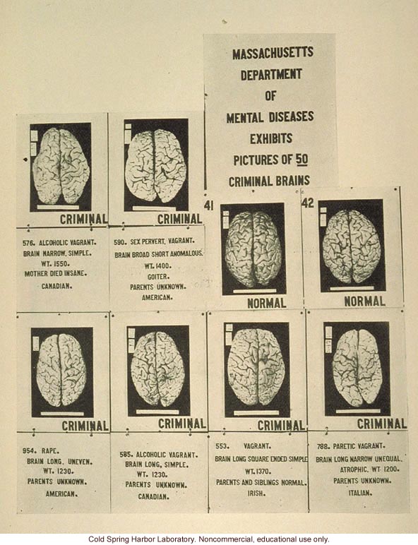 &quote;Massachusetts department of mental diseases exhibits pictures of 59 criminal brains&quote;
