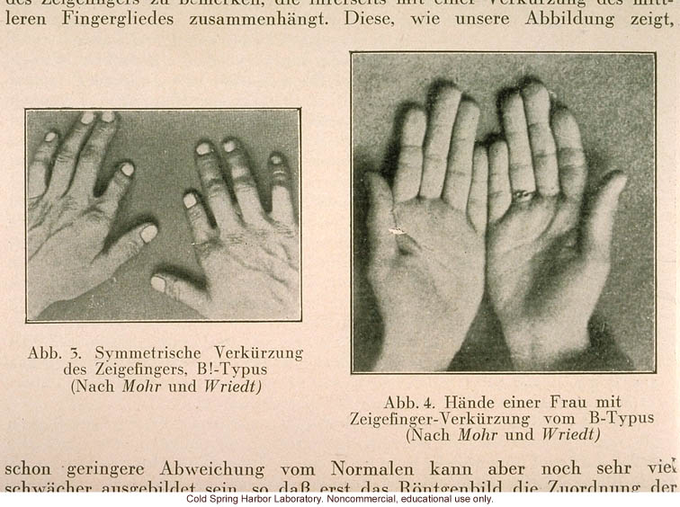 Eugenik: Erblehre, erbpflege (Eugenics: Hereditary teaching, preservation), October 1930