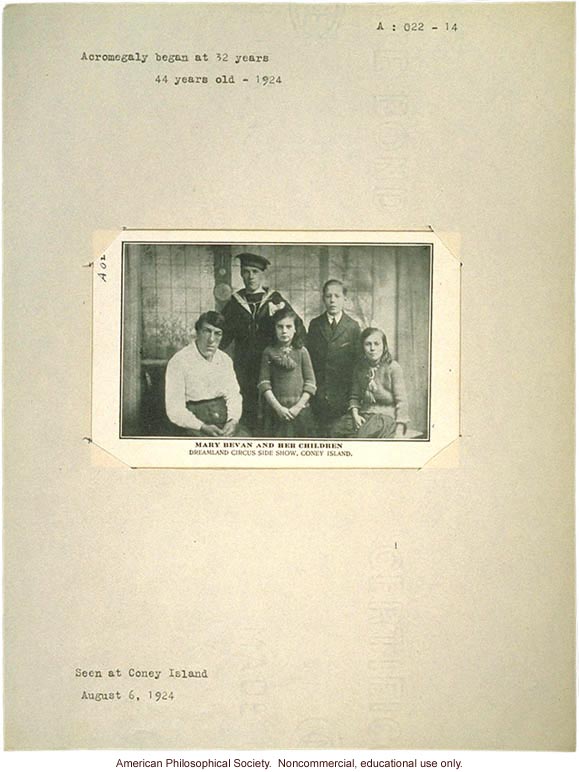 &quote;Mary Bevan and her children,&quote; acromegaly