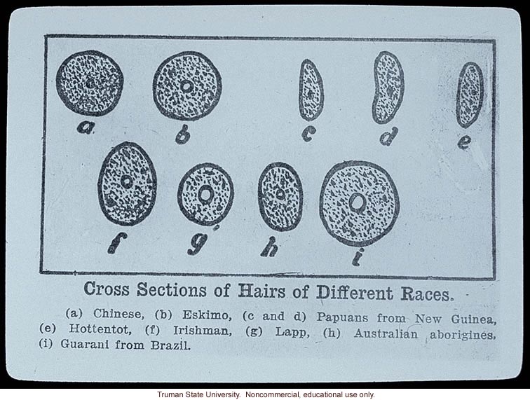 &quote;Cross sections of hairs of different races&quote;