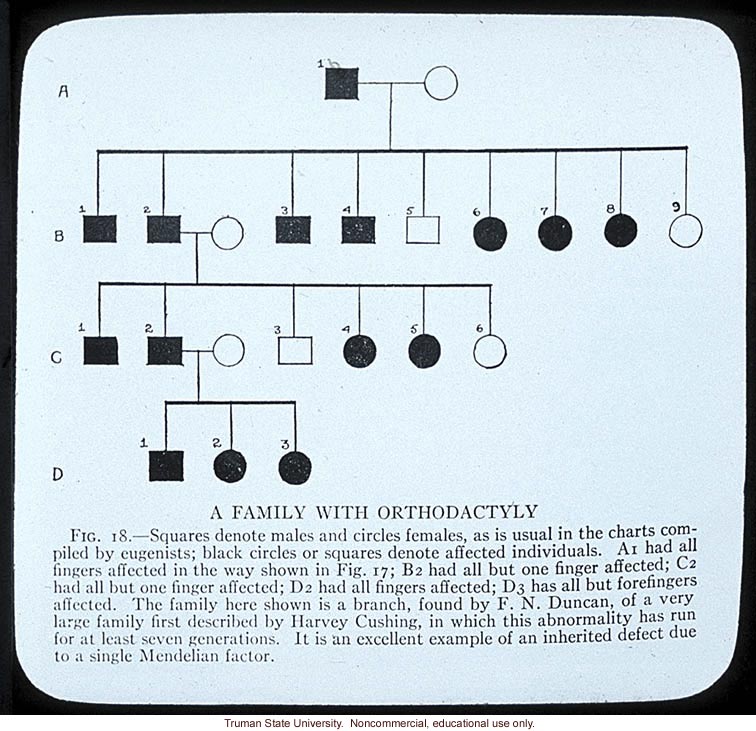 Pedigree: &quote;A family with orthodactyly&quote;